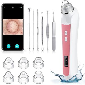 V3 Blackhead Remover Vacuum, USB Interface Type Pore Vacuum, Black Head Extractions Tool with Camerafor, Men and Women Pore Cleaner, 3 Adjustment Modes & 6 Suction Heads(Light Pink)